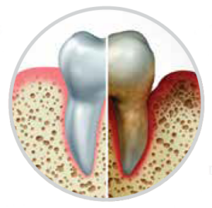 tooth